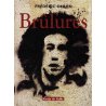 Brûlures